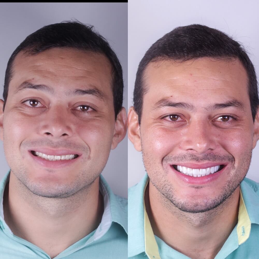 Mateus (1) (1)